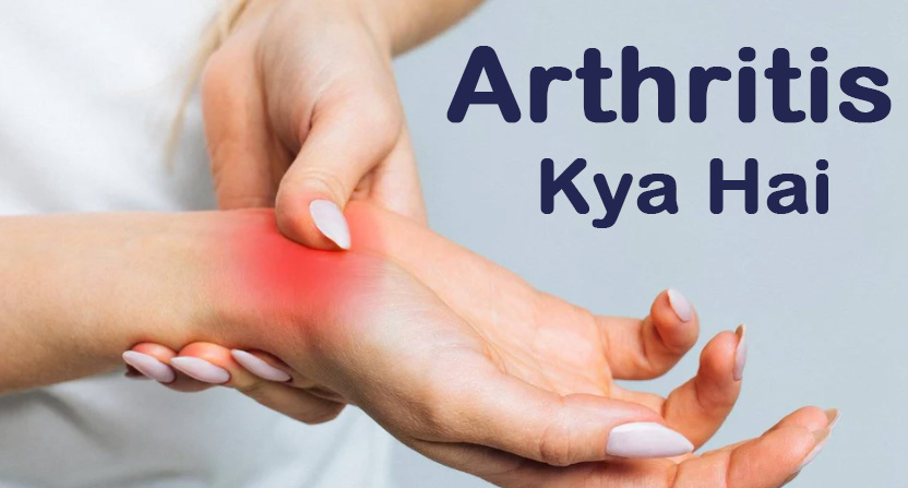 Arthritis Kya Hai